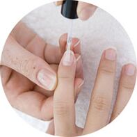 nail polish application to treat nail fungus
